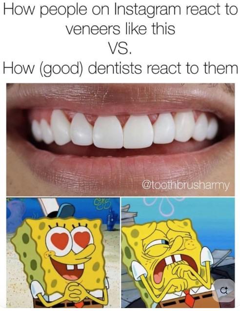 How people on Instagram react to veneers like this VS. How (good) dentists react to them @toothbrusharmy 8 www