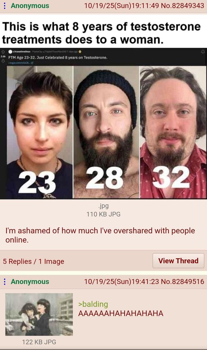 : Anonymous 10/19/25(Sun)19:11:49 No.82849343 This is what 8 years of testosterone treatments does to a woman. /tramtimelines Pott bete007 2. FTM Age 23-32. Just Celebrated 8 years on Testosterone. 28 32 23 28 .jpg 110 KB JPG I'm ashamed of how much I've overshared with people online. 5 Replies 1 Image : Anonymous 122 KB JPG View Thread 10/19/25(Sun)19:41:23 No.82849516 >balding AAAAAAHAHAHAHAHA