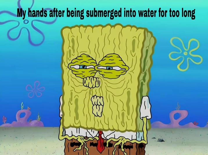 My hands after being submerged into water for too long of