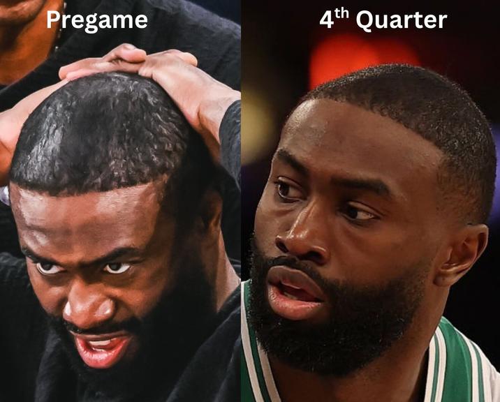 A "meme":https://knowyourmeme.com/memes/memes about Boston Celtics "NBA":https://knowyourmeme.com/memes/cultures/basketball player Jaylen Brown's fake hairline and hair dye use.