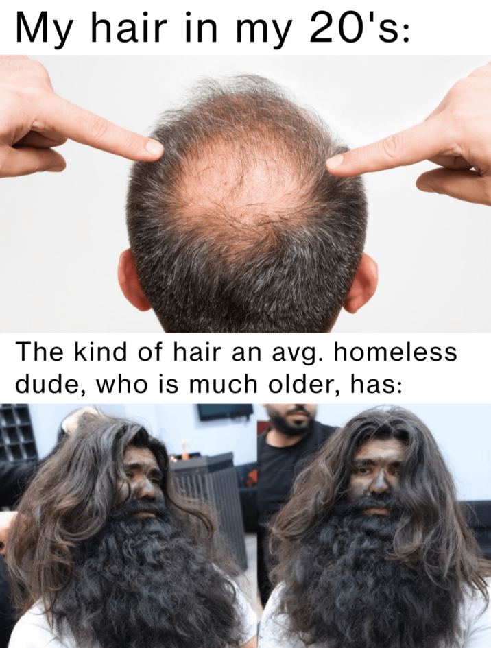 My hair in my 20's: The kind of hair an avg. homeless dude, who is much older, has: