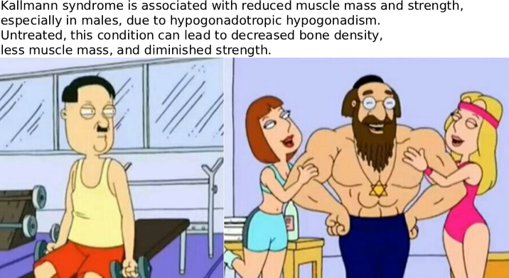 Kallmann syndrome is associated with reduced muscle mass and strength, especially in males, due to hypogonadotropic hypogonadism. Untreated, this condition can lead to decreased bone density, less muscle mass, and diminished strength.