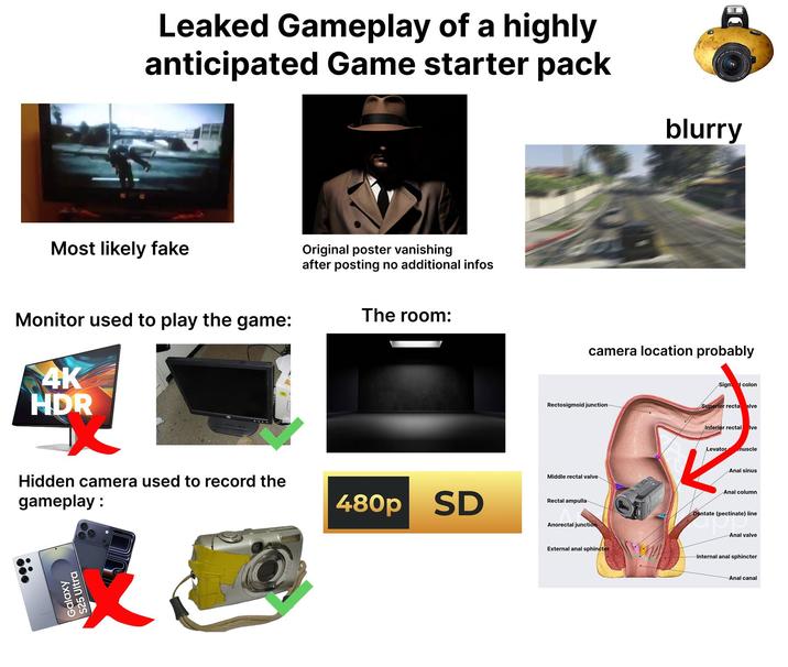Leaked Gameplay of a highly anticipated Game starter pack Most likely fake Monitor used to play the game: 4K HDR Hidden camera used to record the gameplay: Galaxy S25 Ultra Original poster vanishing after posting no additional infos The room: 480p SD DE blurry camera location probably Rectosigmoid junction Middle rectal valve- Rectal ampulla Anorectal junction External a--- sphincter Sigm colon Superior recta alve Inferior rectal Ive Levator muscle A--- sinus A--- column Dentate (pectinate) line -A--- valve Internal a--- sphincter A--- canal