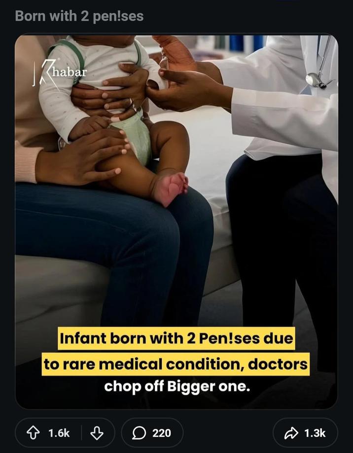 Born with 2 pen!ses Kha Zhabar Infant born with 2 Pen!ses due to rare medical condition, doctors chop off Bigger one. 1.6k ♡ 220 1.3k