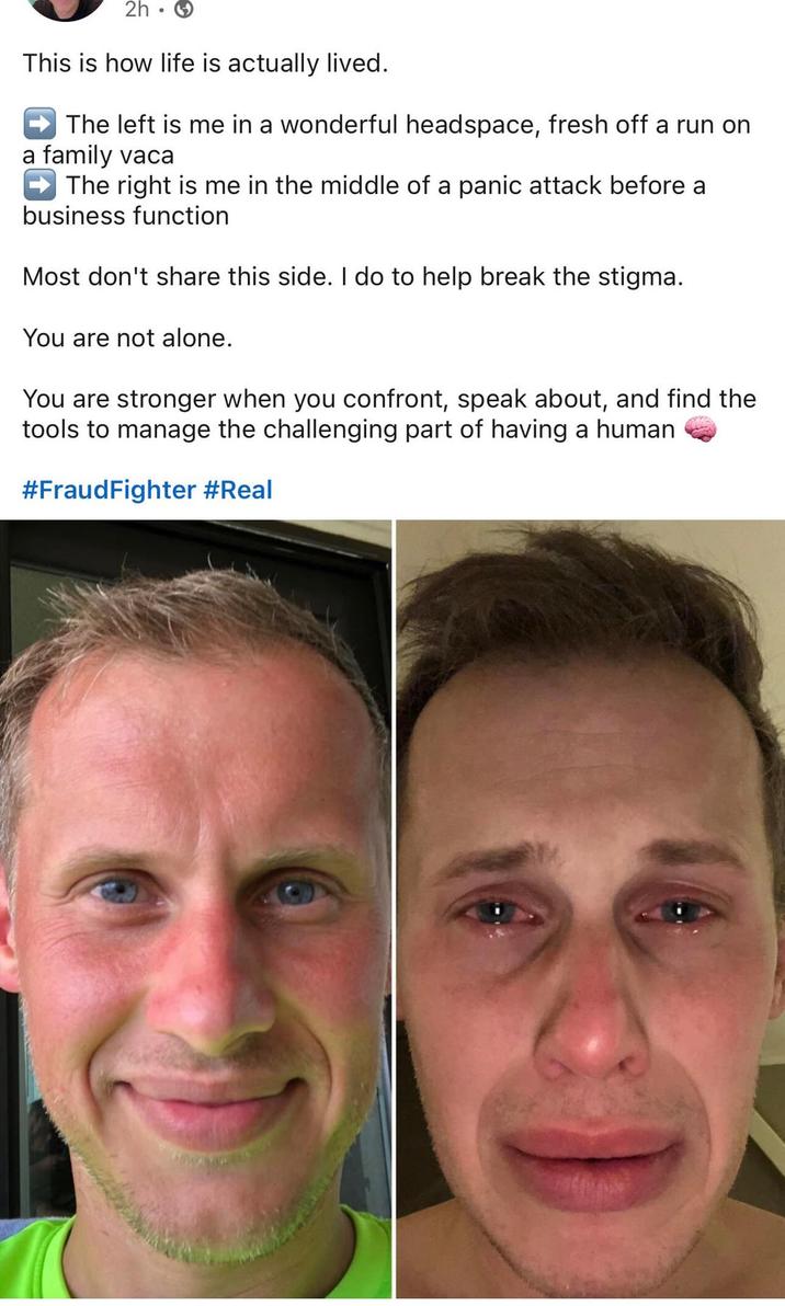 2h⚫ This is how life is actually lived. The left is me in a wonderful headspace, fresh off a run on a family vaca The right is me in the middle of a panic attack before a business function Most don't share this side. I do to help break the stigma. You are not alone. You are stronger when you confront, speak about, and find the tools to manage the challenging part of having a human #FraudFighter #Real