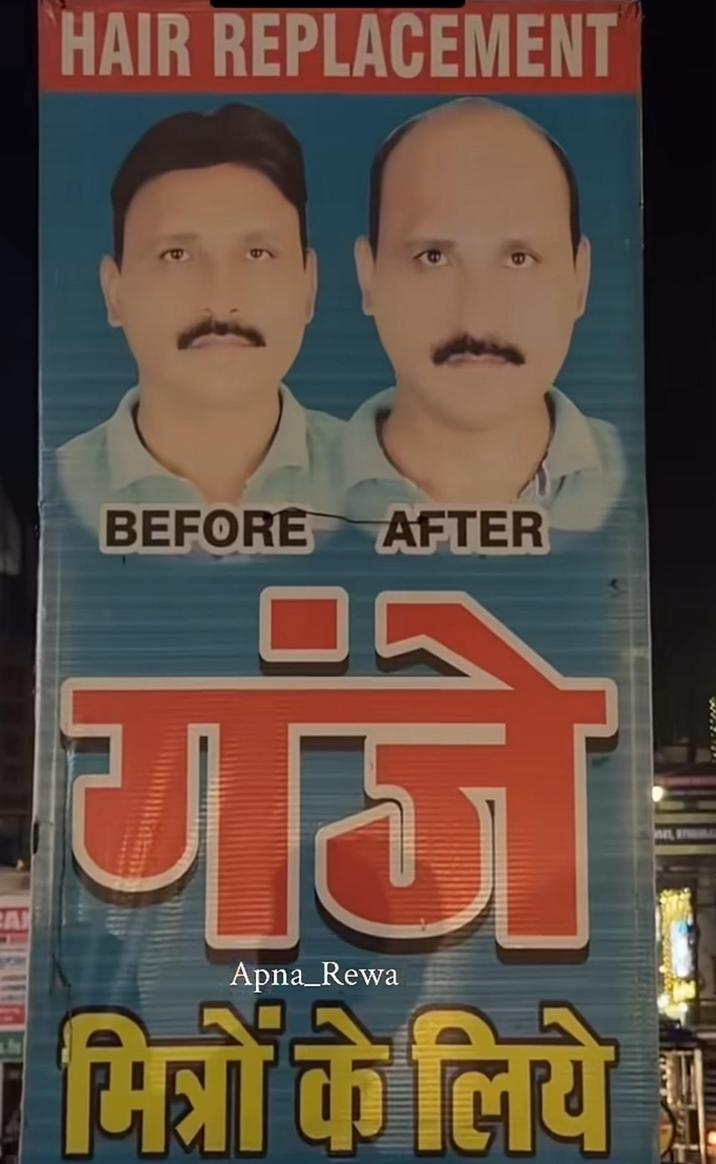 HAIR REPLACEMENT A BEFORE AFTER गंजे Apna_Rewa मित्रों के लिये से