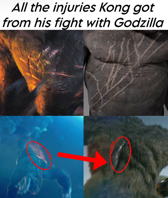 All the injuries Kong got from his fight with Godzilla