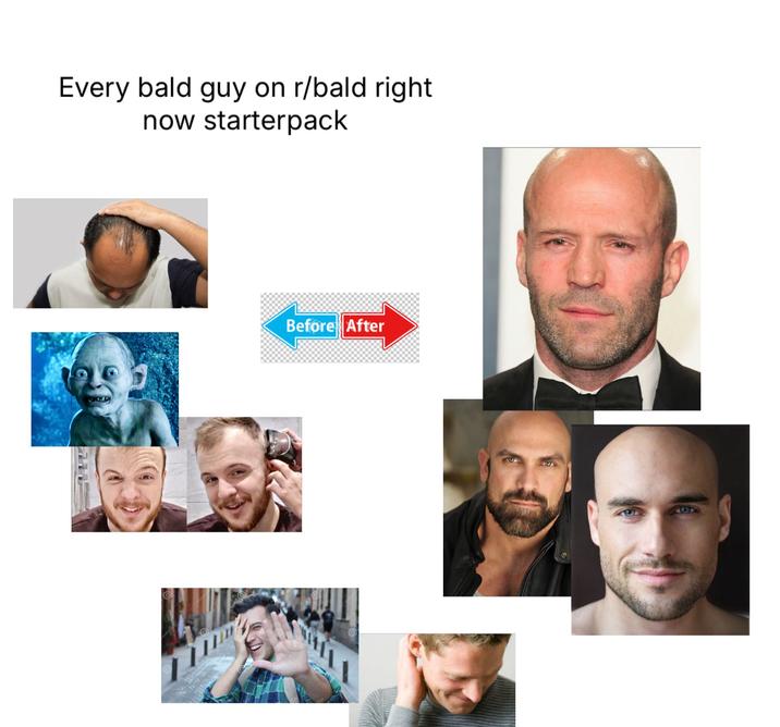 Every bald guy on r/bald right now starterpack Before After