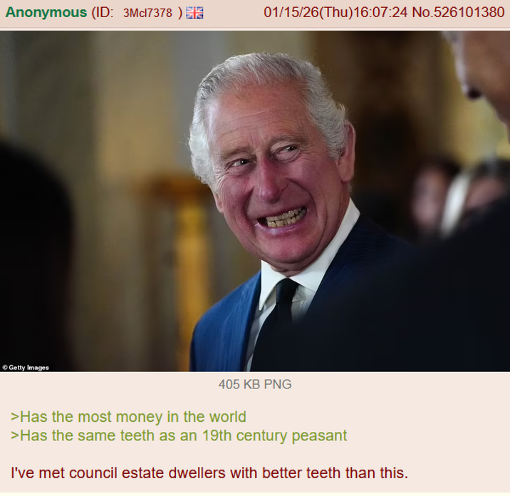 Anonymous (ID: 3Mcl7378) EIG 01/15/26(Thu)16:07:24 No.526101380 Getty Images 405 KB PNG >Has the most money in the world >Has the same teeth as an 19th century peasant I've met council estate dwellers with better teeth than this.