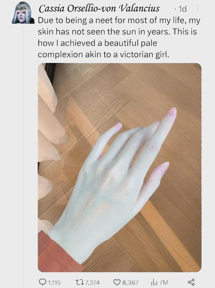 Cassia Orsellio-von Valancius .1d Due to being a neet for most of my life, my skin has not seen the sun in years. This is how I achieved a beautiful pale complexion akin to a victorian girl. 1,115 177,374 8,367 M до