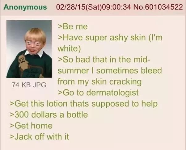 Anonymous 02/28/15(Sat)09:00:34 No.601034522 >Be me >Have super ashy skin (I'm white) >So bad that in the mid- summer I sometimes bleed 74 KB JPG from my skin cracking >Go to dermatologist >Get this lotion thats supposed to help >300 dollars a bottle >Get home >J------- with it