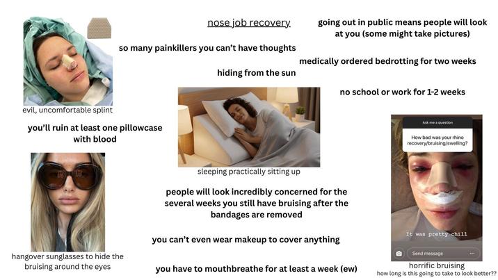 nose job recovery. so many painkillers you can't have thoughts going out in public means people will look at you (some might take pictures) medically ordered bedrotting for two weeks evil, uncomfortable splint you'll ruin at least one pillowcase with blood hiding from the sun no school or work for 1-2 weeks Ask me a question How bad was your rhino recovery/bruising/swelling? hangover sunglasses to hide the bruising around the eyes sleeping practically sitting up people will look incredibly concerned for the several weeks you still have bruising after the bandages are removed you can't even wear makeup to cover anything you have to mouthbreathe for at least a week (ew) It was pretty chill Send message horrific bruising how long is this going to take to look better??