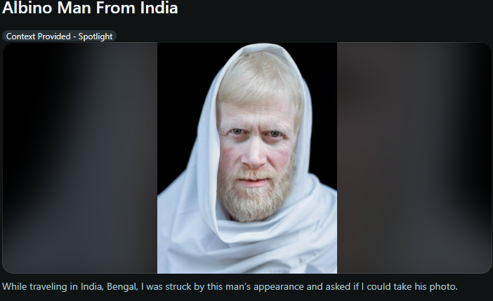 Albino Man From India Context Provided - Spotlight While traveling in India, Bengal, I was struck by this man's appearance and asked if I could take his photo.