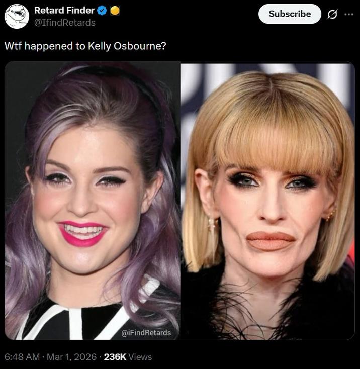 A before and after post of Kelly Osbourne. The poster asks, "W-- happened to Kelly Osbourne?"