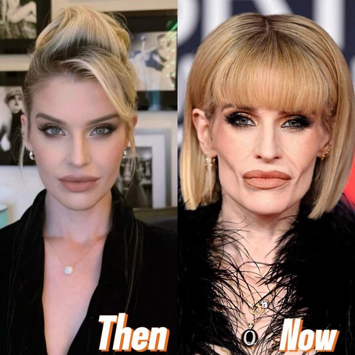 Then Now