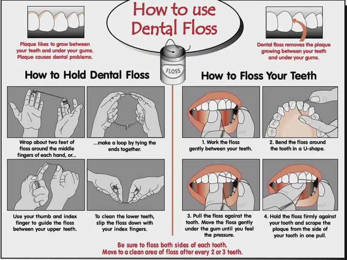 Plaque likes to grow between your teeth and under your gums. Plaque causes dental problems. How to use Dental Floss How to Hold Dental Floss FLOSS DOS Dental floss removes the plaque growing between your teeth and under your gums. How to Floss Your Teeth Wrap about two feet of floss around the middle fingers of each hand, or... ...make a loop by tying the ends together. 1. Work the floss gently between your teeth. Use your thumb and index finger to guide the floss between your upper teeth. To clean the lower teeth, slip the floss down with your index fingers. 3. Pull the floss against the tooth. Move the floss gently under the gum until you feel the pressure. Be sure to floss both sides of each tooth. Move to a clean area of floss after every 2 or 3 teeth. 2. Bend the floss around the tooth in a U-shape. 4. Hold the floss firmly against your tooth and scrape the plaque from the side of your tooth in one pull.
