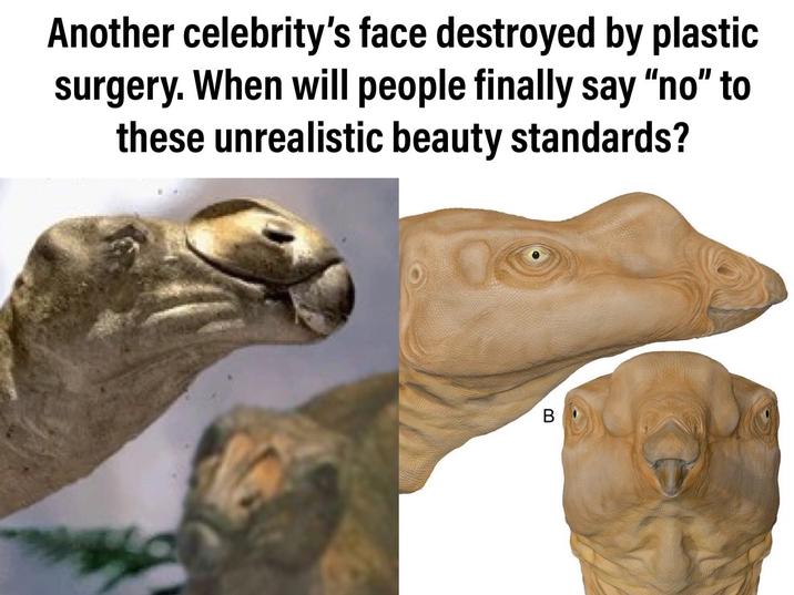 Another celebrity's face destroyed by plastic surgery. When will people finally say "no" to these unrealistic beauty standards? B