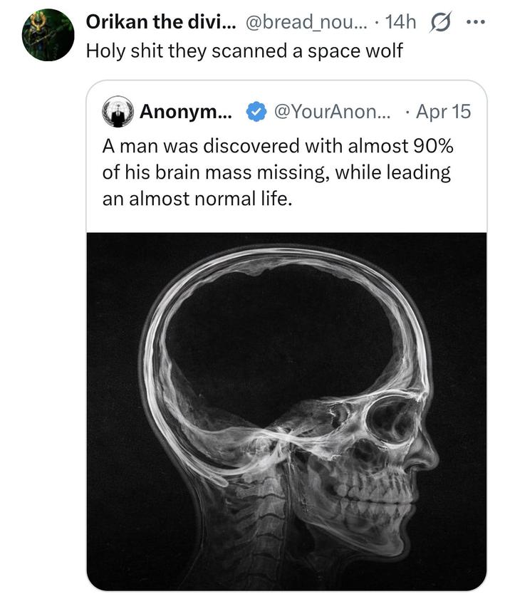 Orikan the divi... @bread_nou.... 14h H-------- they scanned a space wolf • Anonym... @YourAnon... Apr 15 A man was discovered with almost 90% of his brain mass missing, while leading an almost normal life.