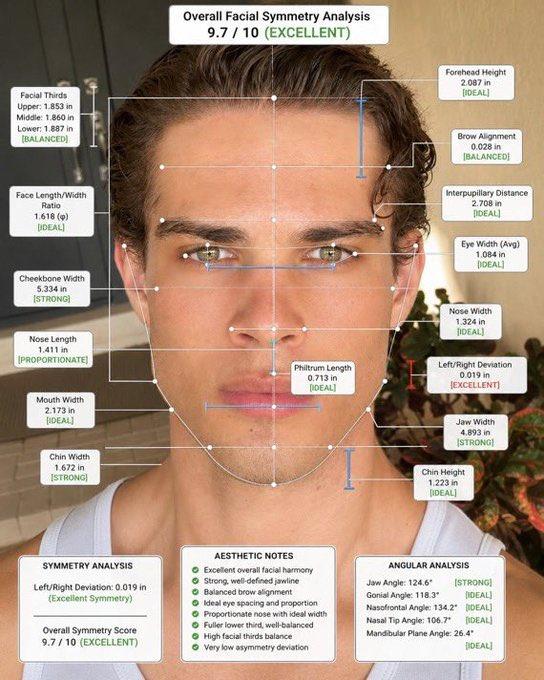 Facial Thirds Upper: 1.853 in Middle: 1.860 in Lower: 1.887 in [BALANCED] Face Length/Width Ratio 1.618 (4) IDEAL] Cheekbone Width 5.334 in [STRONG] Nose Length 1.411 in PROPORTIONATE] Mouth Width 2.173 in IDEAL] Chin Width 1.672 in [STRONG] Overall Facial Symmetry Analysis 9.7/10 (EXCELLENT) Forehead Height 2.087 in [IDEAL] Brow Alignment 0.028 in [BALANCED] Interpupillary Distance 2.708 in [IDEAL] Eye Width (Avg) 1.084 in IDEAL Philtrum Length 0.713 in [IDEAL] Nose Width 1.324 in [IDEAL) Left/Right Deviation 0.019 in [EXCELLENT] Jaw Width 4.893 in [STRONG] Chin Height 1.223 in [IDEAL] SYMMETRY ANALYSIS Left/Right Deviation: 0.019 in (Excellent Symmetry) Overall Symmetry Score 9.7/10 (EXCELLENT) AESTHETIC NOTES Excellent overall facial harmony Strong, well-defined jawline Balanced brow alignment Ideal eye spacing and proportion Proportionate nose with ideal width Fuller lower third, well-balanced High facial thirds balance Very low asymmetry deviation ANGULAR ANALYSIS Jaw Angle: 124.6" Gonial Angle: 118.3* [STRONG] [IDEAL] Nasofrontal Angle: 134.2" [IDEAL] Nasal Tip Angle: 106.7" [IDEAL] Mandibular Plane Angle: 26.4" IDEAL]