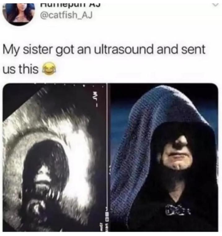 питерин мә @catfish_AJ My sister got an ultrasound and sent us this MUST