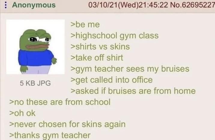 Anonymous 5 KB JPG 03/10/21(Wed)21:45:22 No.62695227 >be me >highschool gym class >shirts vs skins >take off shirt >gym teacher sees my bruises. >get called into office >asked if bruises are from home >no these are from school >oh ok >never chosen for skins again >thanks gym teacher