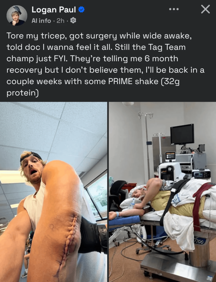 Logan Paul ❤ Al info 2h 8 Tore my tricep, got surgery while wide awake, told doc I wanna feel it all. Still the Tag Team champ just FYI. They're telling me 6 month recovery but I don't believe them, I'll be back in a couple weeks with some PRIME shake (32g protein) Х G 7700