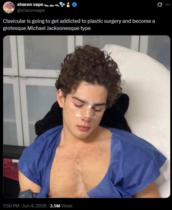 sharon vape a @sharonvape Clavicular is going to get addicted to plastic surgery and become a grotesque Michael Jacksonesque type 7:50 PM - Jun 4, 2026 3.5M Views Ø ...