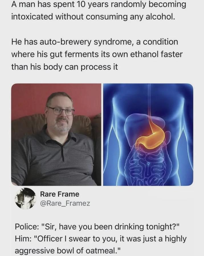 A man has spent 10 years randomly becoming intoxicated without consuming any alcohol. He has auto-brewery syndrome, a condition where his gut ferments its own ethanol faster than his body can process it Rare Frame @Rare_Framez Police: "Sir, have you been drinking tonight?" Him: "Officer I swear to you, it was just a highly aggressive bowl of oatmeal."