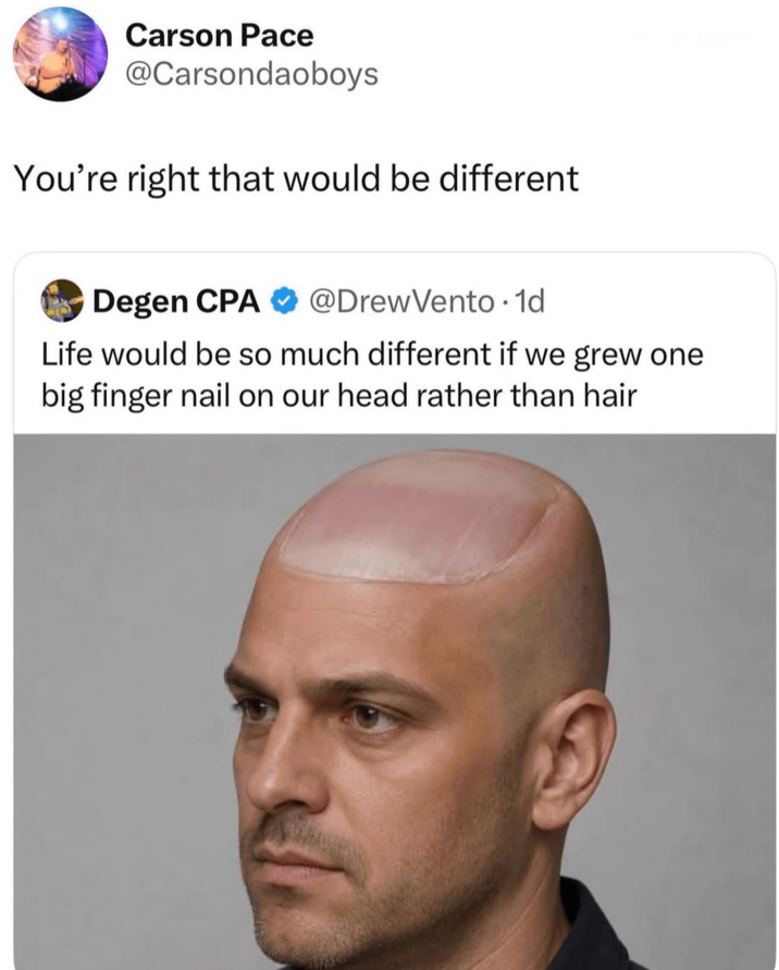 Carson Pace @Carsondaoboys You're right that would be different Degen CPA @DrewVento. 1d Life would be so much different if we grew one big finger nail on our head rather than hair