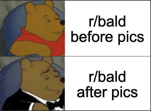 r/bald before pics r/bald after pics