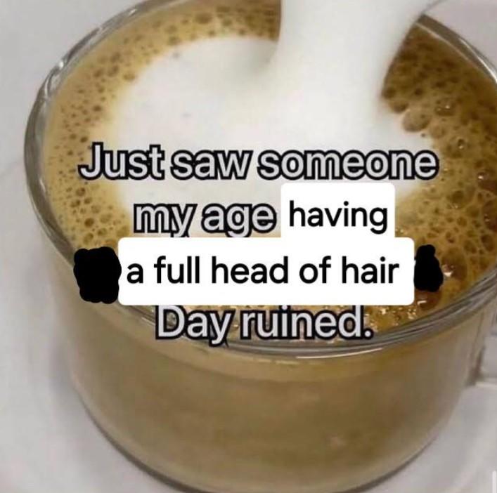 Just saw someone my age having a full head of hair Day ruined.