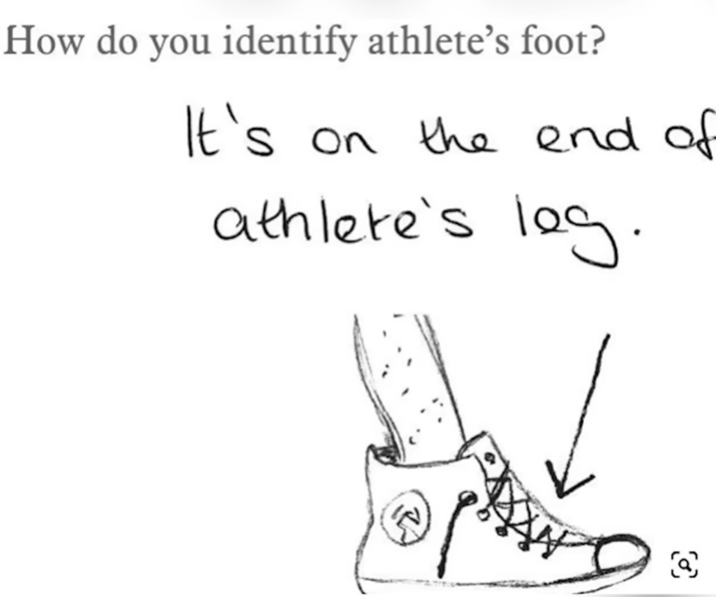 How do you identify athlete's foot? It's S on the end of athlete's leg.