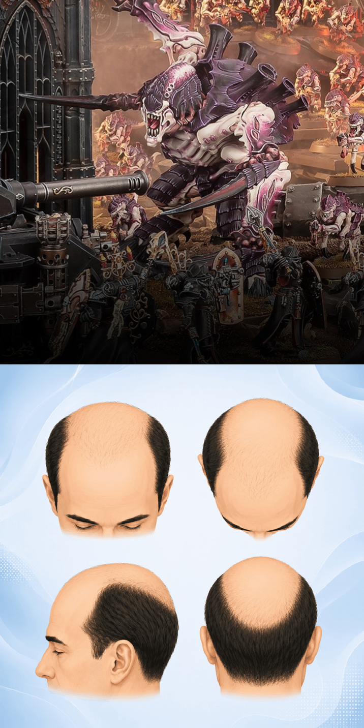 00