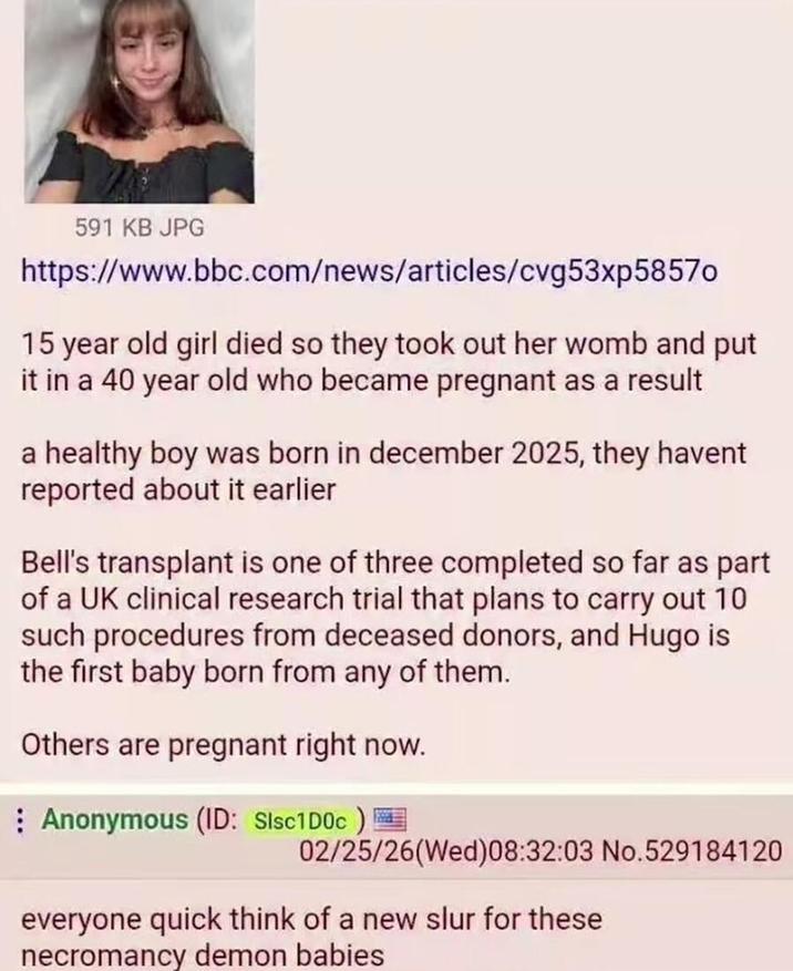 591 KB JPG https://www.bbc.com/news/articles/cvg53xp58570 15 year old girl died so they took out her womb and put it in a 40 year old who became pregnant as a result a healthy boy was born in december 2025, they havent reported about it earlier Bell's transplant is one of three completed so far as part of a UK clinical research trial that plans to carry out 10 such procedures from deceased donors, and Hugo is the first baby born from any of them. Others are pregnant right now. Anonymous (ID: Sisc1D0C)! 02/25/26(Wed)08:32:03 No.529184120 everyone quick think of a new slur for these necromancy demon babies