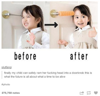 before after slutfang: finally my child can safely ram her f------ head into a doorknob this is what the future is all about what a time to be alive #photo 275,758 notes け