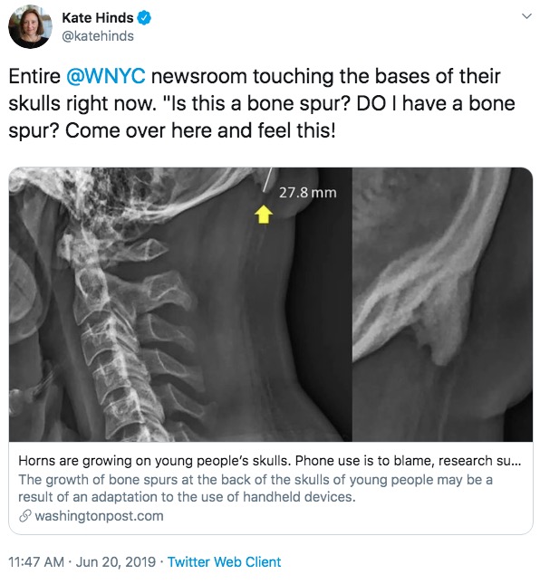 Kate Hinds @katehinds Entire @WNYC newsroom touching the bases of their skulls right now. "Is this a bone spur? DO I have a bone spur? Come over here and feel this! 27.8 mm Horns are growing on young people's skulls. Phone use is to blame, research su... The growth of bone spurs at the back of the skulls of young people may be a result of an adaptation to the use of handheld devices. washingtonpost.com 11:47 AM Jun 20, 2019 Twitter Web Client
