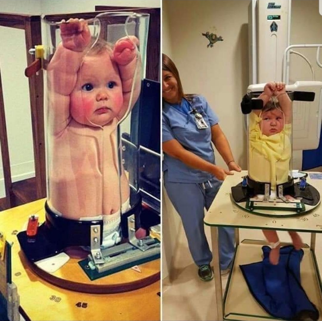 baby-s-getting-x-rays-r-mildlyinteresting-mildly-interesting-know