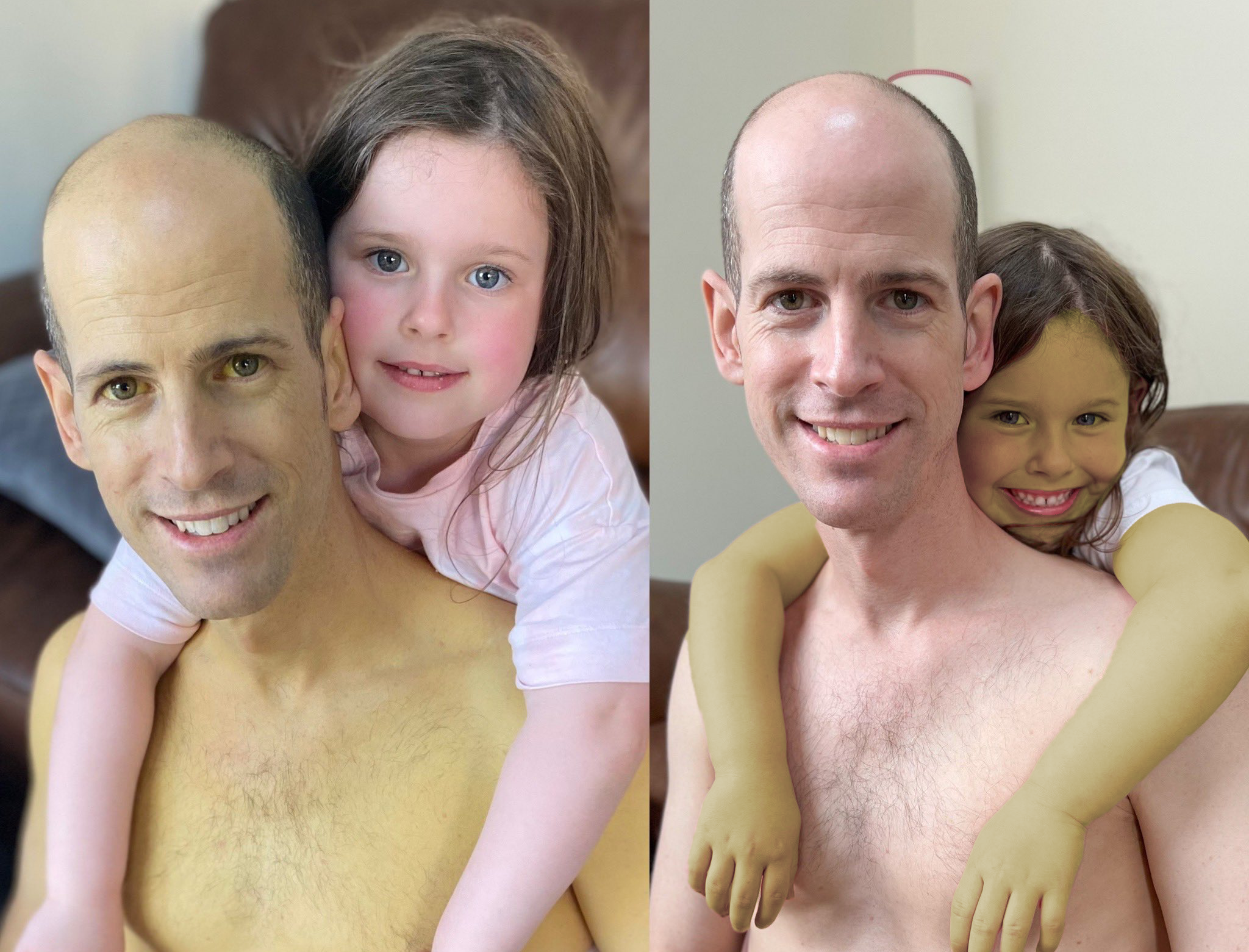 Dr joel kaplan before and after