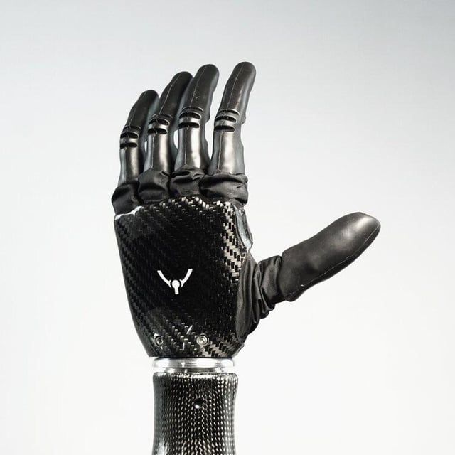 This bionic hand allows amputees to feel what they touch