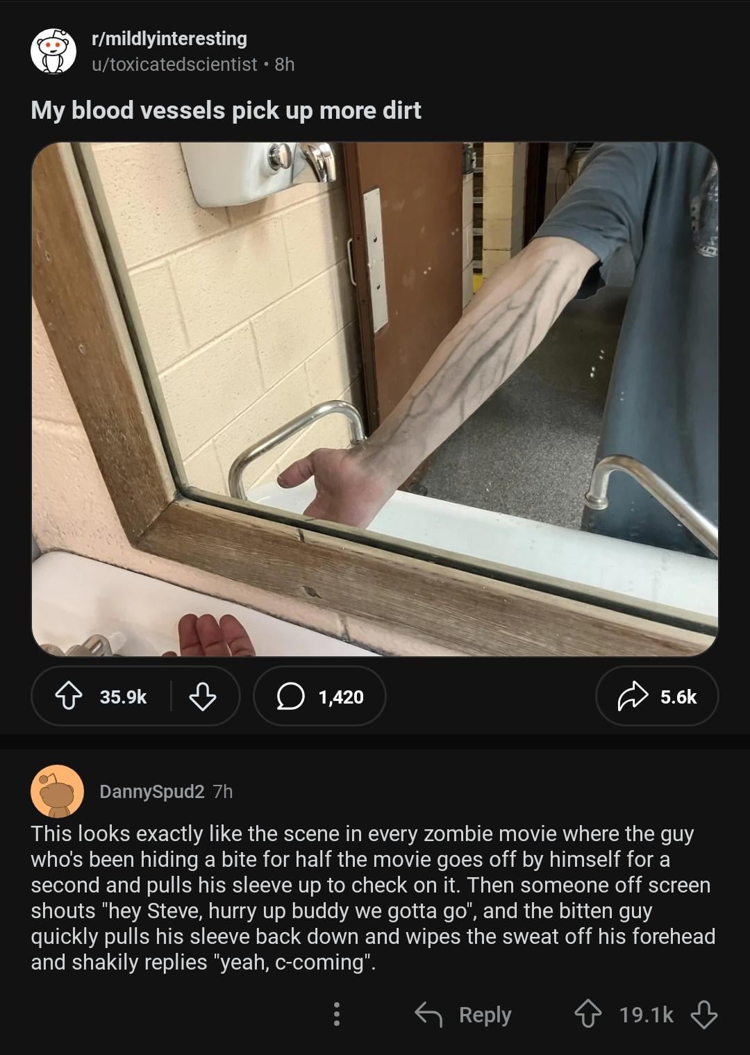 r/mildlyinteresting u/toxicatedscientist • 8h My blood vessels pick up more dirt 35.9k ♡ 1,420 5.6k DannySpud2 7h This looks exactly like the scene in every zombie movie where the guy who's been hiding a bite for half the movie goes off by himself for a second and pulls his sleeve up to check on it. Then someone off screen shouts "hey Steve, hurry up buddy we gotta go", and the bitten guy quickly pulls his sleeve back down and wipes the sweat off his forehead and shakily replies "yeah, c-coming". ← Reply 19.1k
