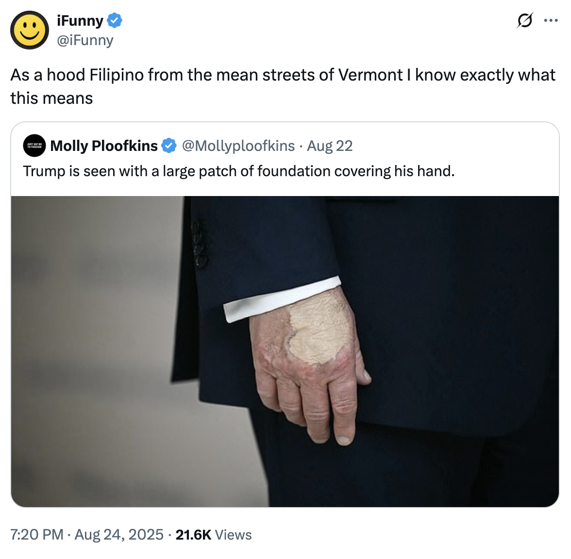 A "quote-tweet":https://knowyourmeme.com/memes/quote-retweets-qrts joking about "Donald Trump":https://knowyourmeme.com/memes/people/donald-trump and the makeup/bruising on his hand, which caused speculation about his impending death.