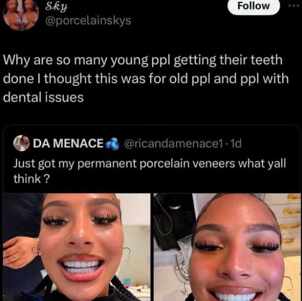 Sky @porcelainskys Follow Why are so many young ppl getting their teeth done I thought this was for old ppl and ppl with dental issues DA MENACE @ricandamenace1-1d Just got my permanent porcelain veneers what yall think?