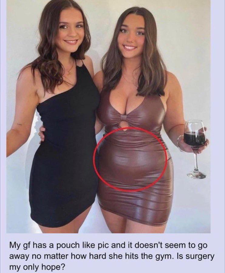 A 4chan post sharing a photograph of Zoe Kalotheos and Jessie Fox. The post reads, "My gf has a pouch like pic and it doesn't seem to go away no matter how hard she hits the gym. Is surgery my only hope?"