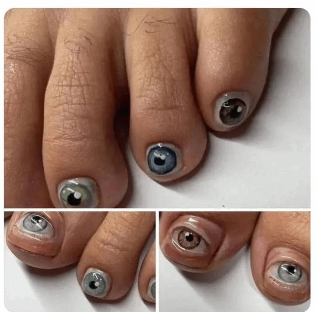 And eyeball toenails