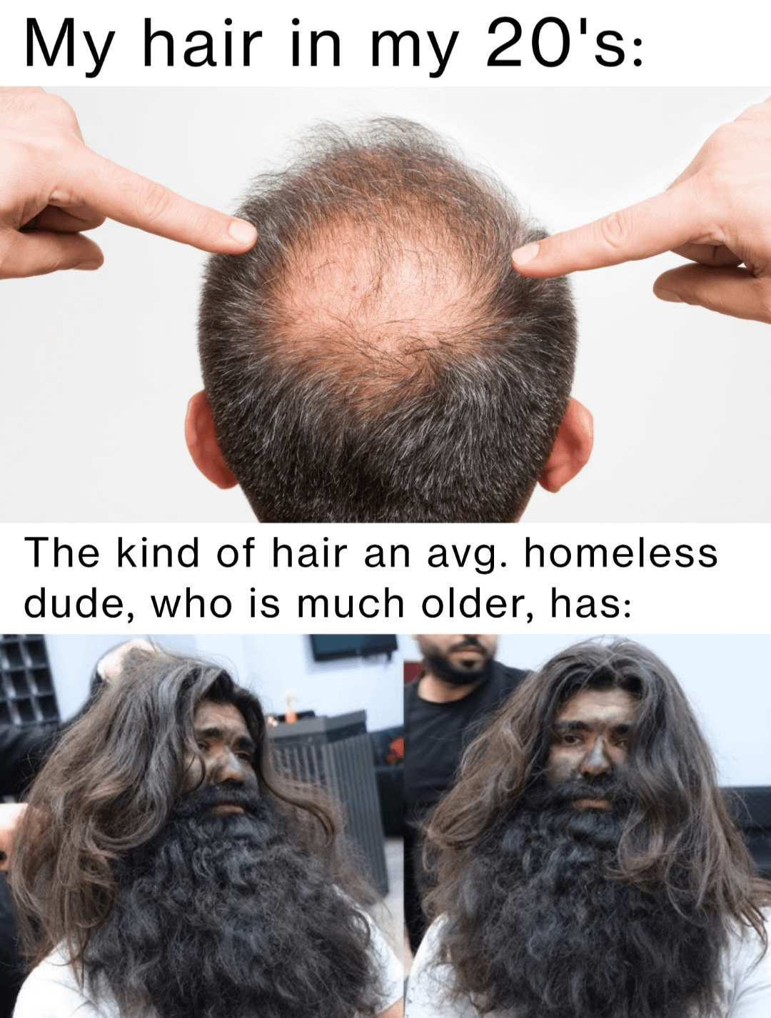 My hair in my 20's: The kind of hair an avg. homeless dude, who is much older, has: