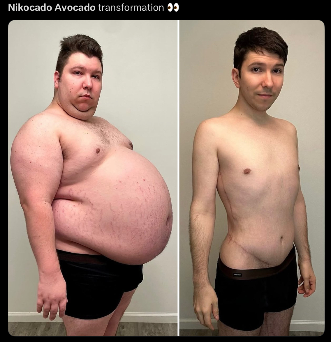 Nikocado Avocado transformation ●●