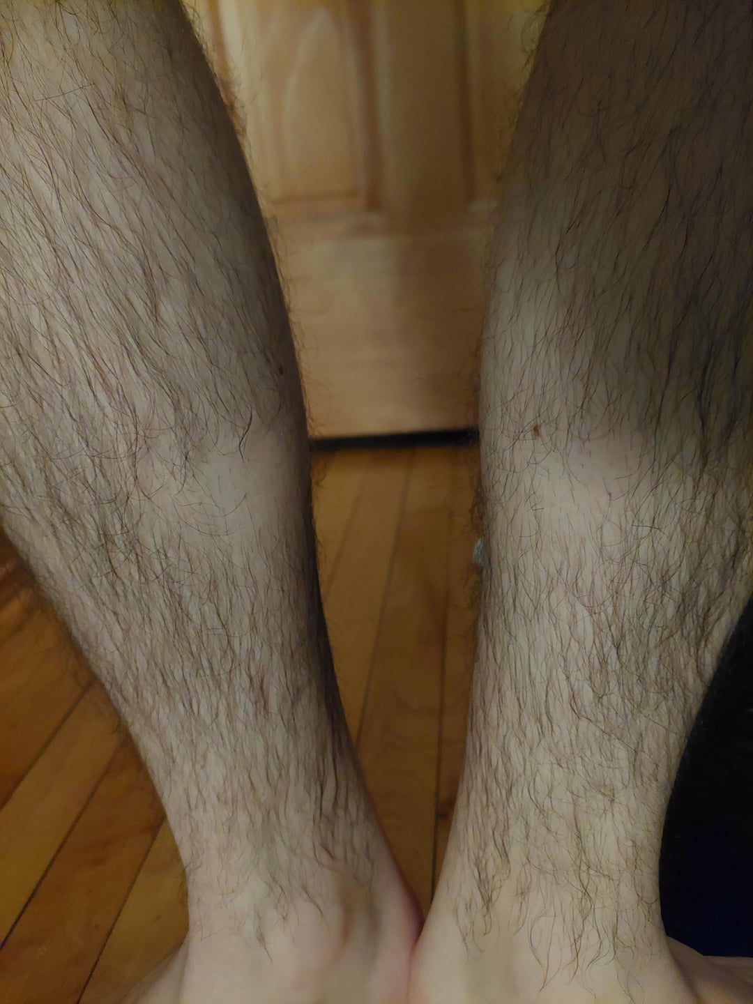 They have one spot on their legs that hair doesn't grow