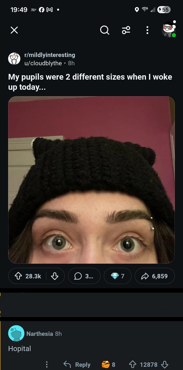 19:49 M. ☑ ib 55 r/mildlyinteresting u/cloudblythe ⚫ 8h My pupils were 2 different sizes when I woke up today... 28.3k 3... 7 6,859 Narthesia 8h Hopital ÷ Reply 8 12878