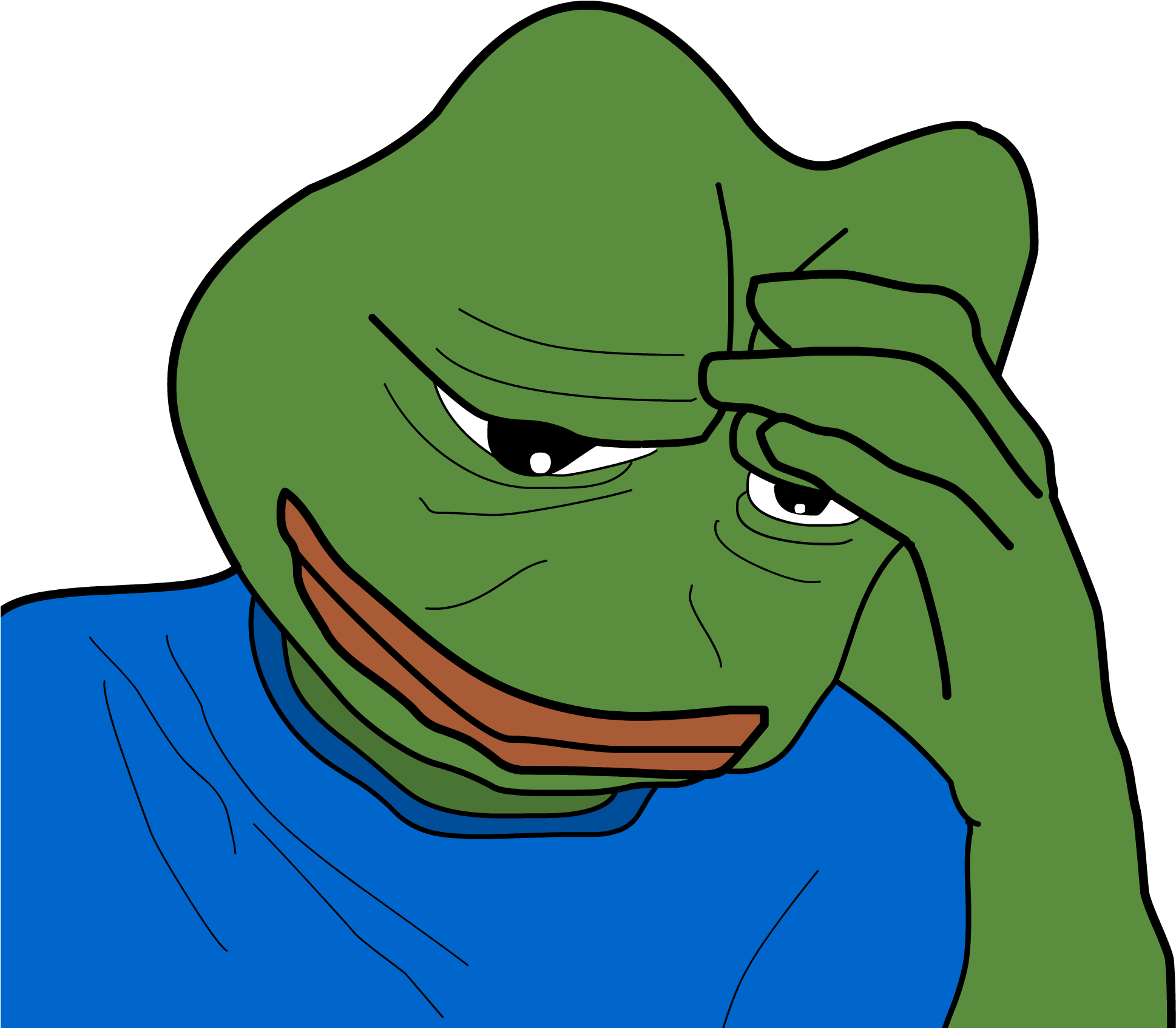Pepe holding head